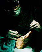 Orthopaedic surgeon examines foot before operation