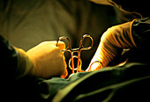 Surgical procedure