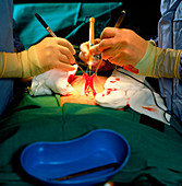 Prostate surgery