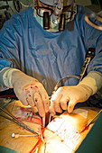 Keyhole heart surgery