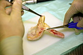 Dissection of knee tendon