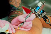 Hands of tattoo artist at work on patient's skin
