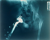 X-ray image of the pelvic area