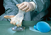 Gloved hands holding a silicone breast implant