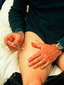 Intramuscular insulin injection into thigh