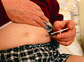 Diabetic self-injecting insulin into his abdomen