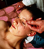Acupuncture treatment for headaches