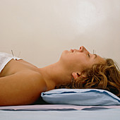 Patient teated for hay fever by Acupuncture