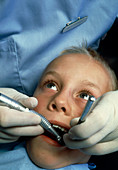 Child having a tooth drilled by a dentist