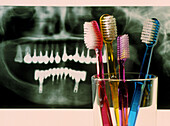 Toothbrushes in front of a dental X-ray of teeth