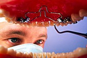 Dentist using probe seen from inside the mouth