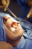 Dental surgery