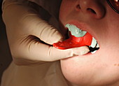 Dental impression