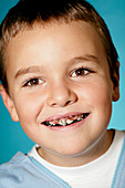 Young boy wearing a dental retainer