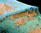 Coloured SEM of the join between a tooth and crown