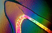 Polarised LM of a cracked ceramic dental crown