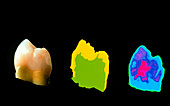Terahertz images of tooth with an internal cavity