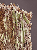 Dental plaque,SEM