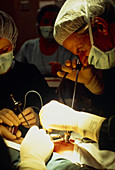 Surgeon implanting egg & sperm in GIFT IVF