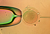 LM of IVF: egg about to be injected with sperm DNA