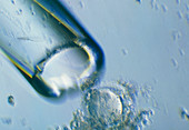 LM of a human egg cell during preparation for IVF