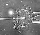 In vitro fertilization,light microscope