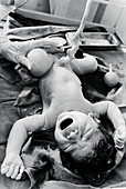 Newborn baby with umbilical cord still attached