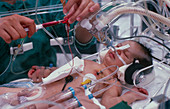 Infant in intensive care