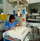 Neonatal infant in intensive care