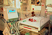 Premature baby on monitor in intensive care unit