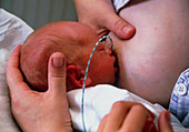 Mother breastfeeding her premature baby