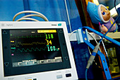 Cardiorespiratory monitor