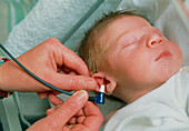 Oto-Acoustic Emission hearing test of a baby