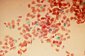 Cervical smear mid-cycle