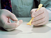 Close-up of cervical sample being smeared on slide