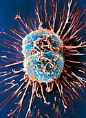 Cervical cancer cells dividing,SEM