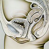 Artwork of retroflexion of the uterus