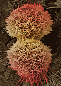Dividing cervical cancer cell,SEM