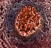 Ovarian cancer blood vessel,SEM