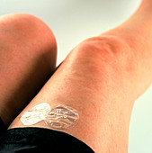 Hormone replacement therapy skin patch on thigh
