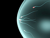 Sperm cells in a condom