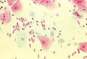 LM of Trichomonas vaginalis in a cervical smear
