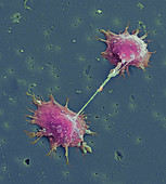 Prostate cancer cells,SEM