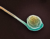 Deformed sperm cell,SEM