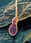 Deformed sperm cell,SEM