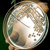 Petri dish culture of a nitrogen fixing bacteria