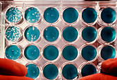 Hepatitis C research: virus culture in dishes