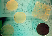 Petri dish cultures of Mycobacterium & DNA profile