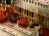 Bacteriology glassware containing samples