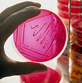 Gloved hand holds petri dish of cultured bacteria